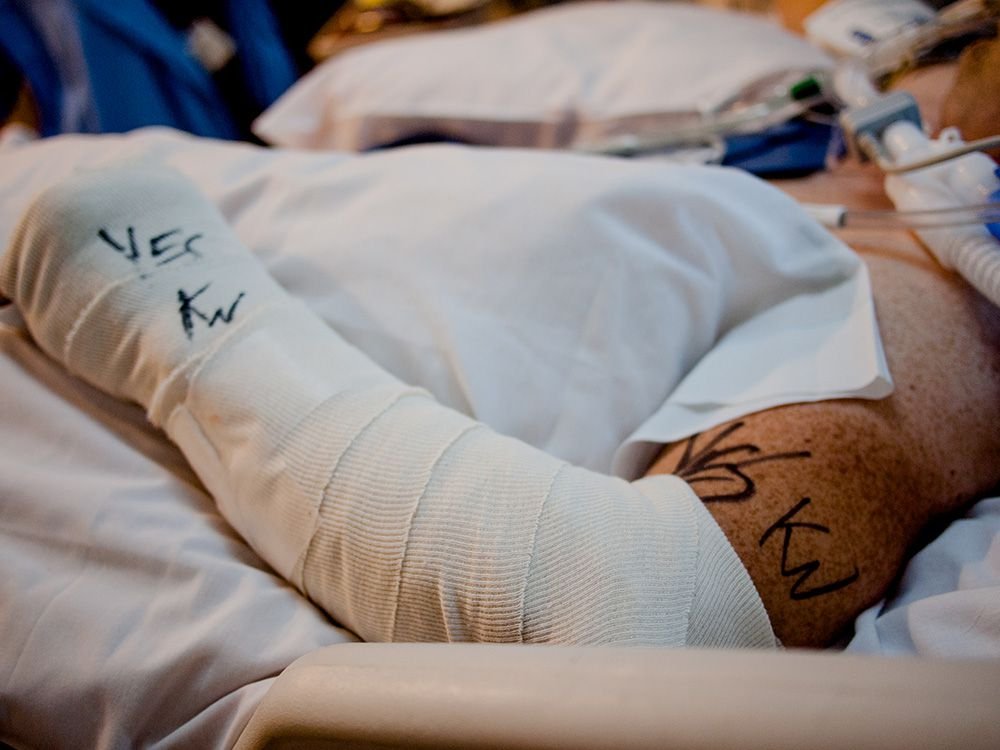 Arm Surgery Update